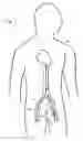 Fig. 02 - Method of treating COPD with artificial arterio-venous fistula and flow mediating systems