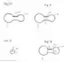 Fig. 06 - Method of treating COPD with artificial arterio-venous fistula and flow mediating systems