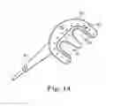 Fig. 09 - Method and devices for treating atrial fibrillation by mass ablation