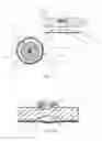 Fig. 02 - Drug delivery device with instable sheath and/or push element