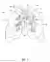Fig. 02 - SYSTEMS, ASSEMBLIES, AND METHODS FOR TREATING A BRONCHIAL TREE
