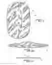 Fig. 02 - Method of hernia repair using surgical mesh