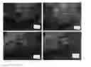 Fig. 08 - Method of hernia repair using surgical mesh