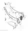 Fig. 03 - Ear pipe