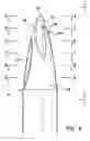 Fig. 03 - Blunt tip obturator