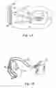 Fig. 02 - Methods and devices for adapting charge initiation for an implantable defibrillator