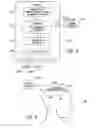 Fig. 07 - METHODS AND APPARATUS FOR EFFECTUATING A LASTING CHANGE IN A NEURAL-FUNCTION OF A PATIENT