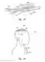 Fig. 19 - METHODS AND APPARATUS FOR EFFECTUATING A LASTING CHANGE IN A NEURAL-FUNCTION OF A PATIENT