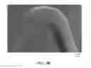 Fig. 11 - Durable Stent Drug Eluting Coating