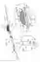 Fig. 03 - Endovascular flow direction indicator