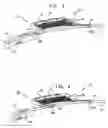 Fig. 05 - Endovascular flow direction indicator