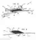 Fig. 06 - Endovascular flow direction indicator