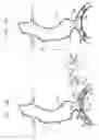 Fig. 12 - Endovascular flow direction indicator