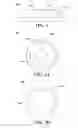 Fig. 02 - Endoprosthesis delivery system