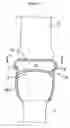 Fig. 02 - RESILIENT MEDICALLY INFLATABLE INTERPOSITIONAL ARTHROPLASTY DEVICE