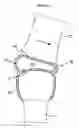 Fig. 03 - RESILIENT MEDICALLY INFLATABLE INTERPOSITIONAL ARTHROPLASTY DEVICE