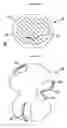 Fig. 04 - RESILIENT MEDICALLY INFLATABLE INTERPOSITIONAL ARTHROPLASTY DEVICE