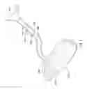 Fig. 05 - Balloon expandable ureteral stent