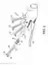 Fig. 03 - Glove rake