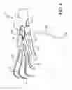 Fig. 04 - Glove rake