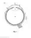 Fig. 02 - Lacrimal implants and related methods
