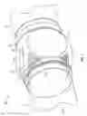 Fig. 02 - TUBULAR VALVING SYSTEM, BODY AND METHOD OF OPENING