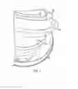 Fig. 10 - STORAGE CONTAINER SYSTEM INCLUDING UNIVERSAL LIDS