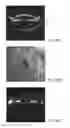 Fig. 07 - Systems and methods for implanting and examining intraocular lens