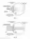 Fig. 08 - Systems and methods for implanting and examining intraocular lens