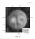 Fig. 22 - Systems and methods for implanting and examining intraocular lens