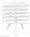 Fig. 06 - Light source having LED arrays for direct operation in alternating current network and production method therefor