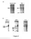 Fig. 06 - Chimeric polynucleotides and polypeptides enabling the secretion of a polypeptide of interest in combination with exosomes and uses thereof
