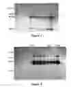 Fig. 07 - Chimeric polynucleotides and polypeptides enabling the secretion of a polypeptide of interest in combination with exosomes and uses thereof