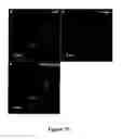 Fig. 10 - Chimeric polynucleotides and polypeptides enabling the secretion of a polypeptide of interest in combination with exosomes and uses thereof