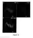 Fig. 12 - Chimeric polynucleotides and polypeptides enabling the secretion of a polypeptide of interest in combination with exosomes and uses thereof