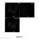 Fig. 13 - Chimeric polynucleotides and polypeptides enabling the secretion of a polypeptide of interest in combination with exosomes and uses thereof