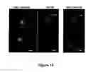Fig. 15 - Chimeric polynucleotides and polypeptides enabling the secretion of a polypeptide of interest in combination with exosomes and uses thereof