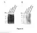 Fig. 25 - Chimeric polynucleotides and polypeptides enabling the secretion of a polypeptide of interest in combination with exosomes and uses thereof