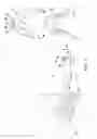 Fig. 03 - Vibrating orthodontic remodelling device