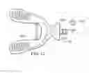 Fig. 10 - Vibrating orthodontic remodelling device
