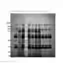 Fig. 03 - METHOD FOR PURIFYING PROTEIN