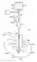 Fig. 01 - NEEDLE DEVICE