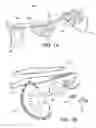 Fig. 02 - Orthopedic device, use of orthopedic device and method for producing same