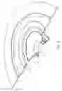Fig. 02 - Seal for an ostomy appliance
