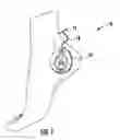 Fig. 02 - Percutaneous tibial nerve stimulator