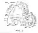 Fig. 09 - Femoral prosthesis system having provisional component with visual indicators
