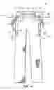 Fig. 02 - Lift support garment system