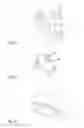 Fig. 08 - Drug delivery device