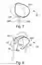 Fig. 08 - Cup Holder for the Visually Impaired