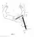 Fig. 07 - Quick adjustable clamp